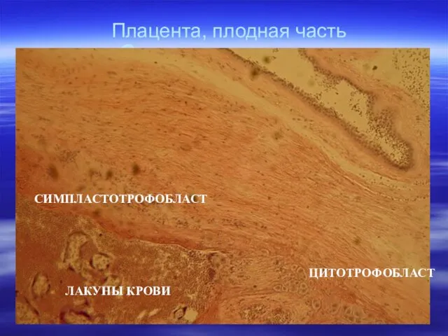 Система мать-плод ЛАКУНЫ КРОВИ ЦИТОТРОФОБЛАСТ СИМПЛАСТОТРОФОБЛАСТ Плацента, плодная часть