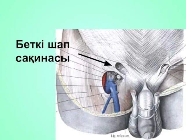 Беткі шап сақинасы