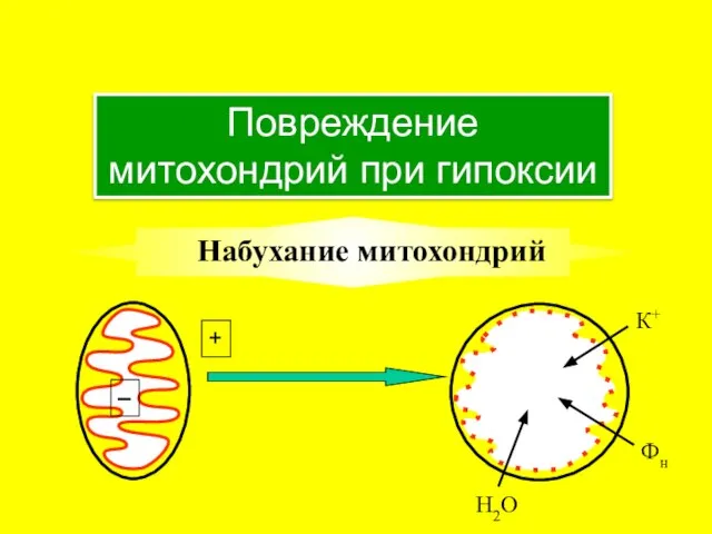 Повреждение митохондрий при гипоксии Набухание митохондрий