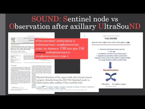 SOUND: Sentinel node vs Observation after axillary UltraSouND «Отсутствие метастаза в