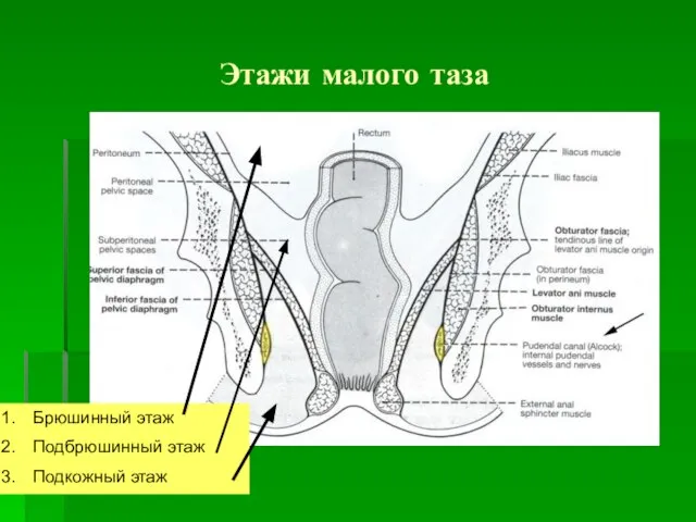 Этажи малого таза Брюшинный этаж Подбрюшинный этаж Подкожный этаж