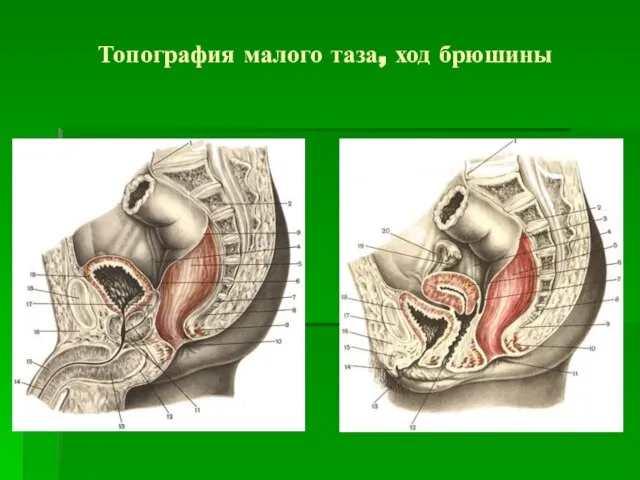 Топография малого таза, ход брюшины