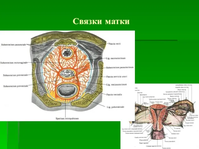 Связки матки