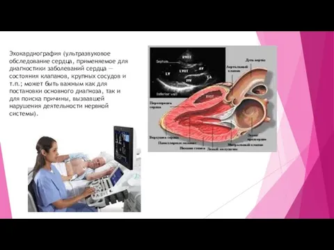 Эхокардиография (ультразвуковое обследование сердца, применяемое для диагностики заболеваний сердца — состояния