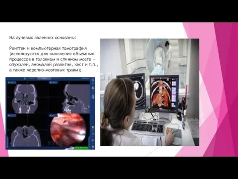 На лучевых явлениях основаны: Рентген и компьютерная томография (используются для выявления