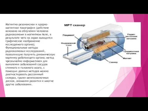 Магнитно-резонансная и ядерно-магнитная томография (действие основано на облучении человека радиоволнами в