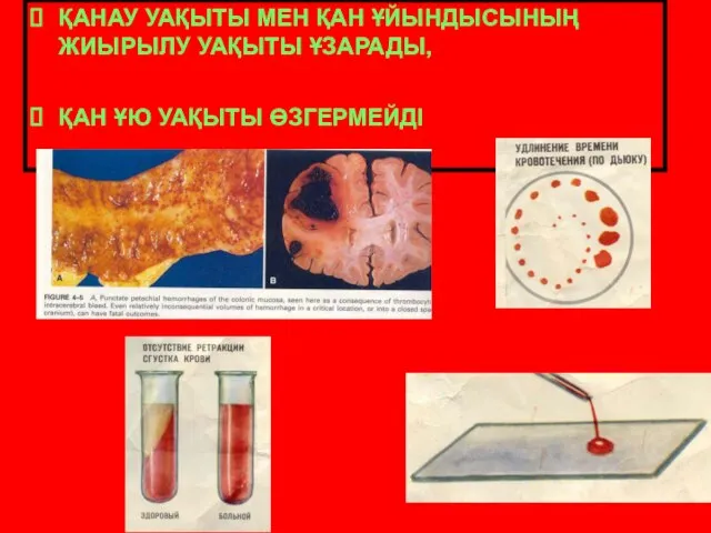 ҚАНАУ УАҚЫТЫ МЕН ҚАН ҰЙЫНДЫСЫНЫҢ ЖИЫРЫЛУ УАҚЫТЫ ҰЗАРАДЫ, ҚАН ҰЮ УАҚЫТЫ ӨЗГЕРМЕЙДІ