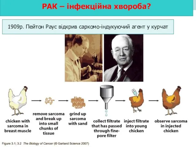 РАК – інфекційна хвороба? 1909р. Пейтон Раус відкрив саркомо-індукуючий агент у курчат