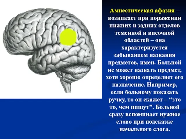 Амнестическая афазия – возникает при поражении нижних и задних отделов теменной