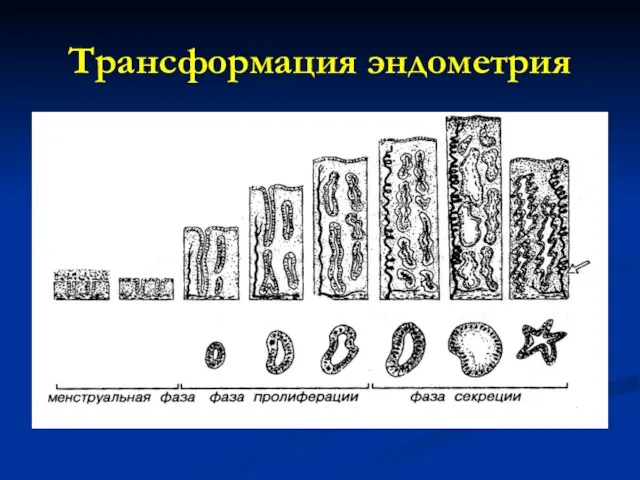 Трансформация эндометрия