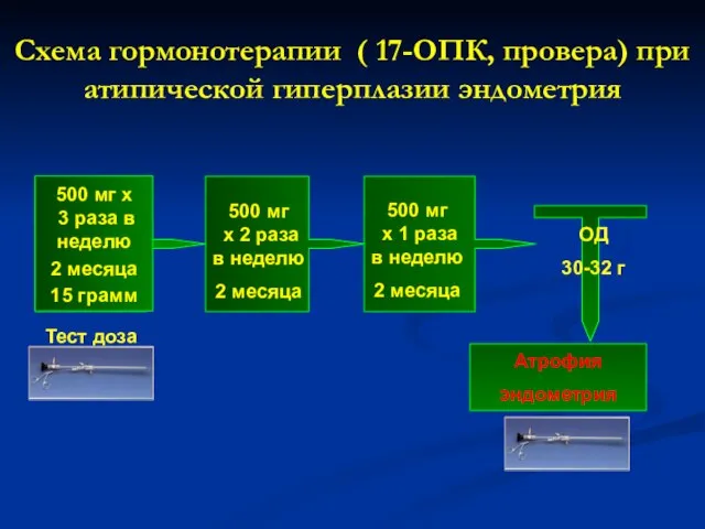 Схема гормонотерапии ( 17-ОПК, провера) при атипической гиперплазии эндометрия 500 мг