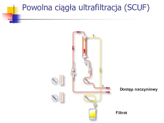 Powolna ciągła ultrafiltracja (SCUF) Dostęp naczyniowy Filtrat