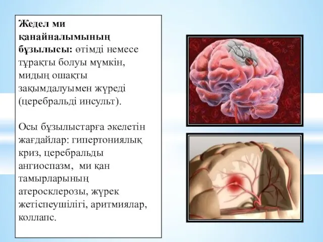 Жедел ми қанайналымының бұзылысы: өтімді немесе тұрақты болуы мүмкін, мидың ошақты