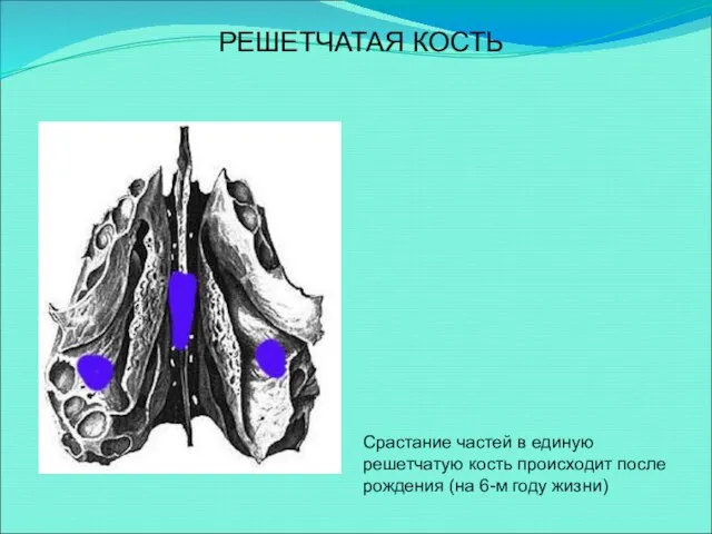 РЕШЕТЧАТАЯ КОСТЬ Срастание частей в единую решетчатую кость происходит после рождения (на 6-м году жизни)