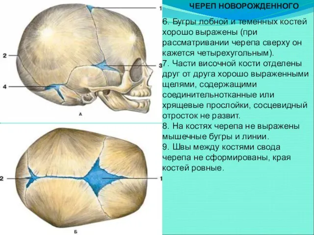 ЧЕРЕП НОВОРОЖДЕННОГО 6. Бугры лобной и теменных костей хорошо выражены (при