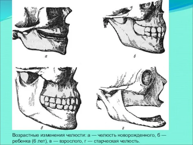 Возрастные изменения челюсти: а — челюсть новорожденного, б — ребенка (6