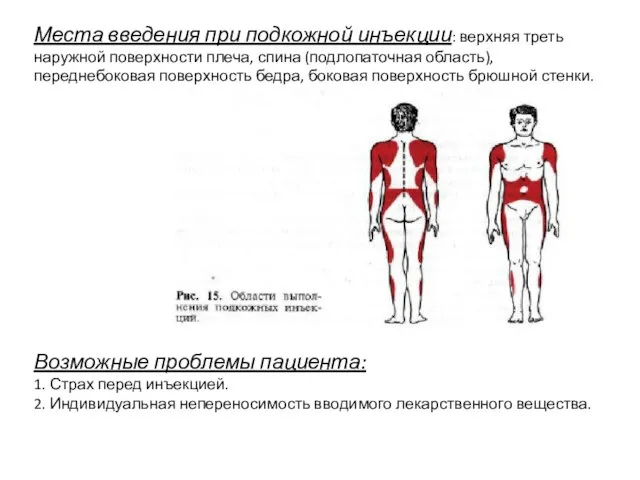 Места введения при подкожной инъекции: верхняя треть наружной поверхности плеча, спина