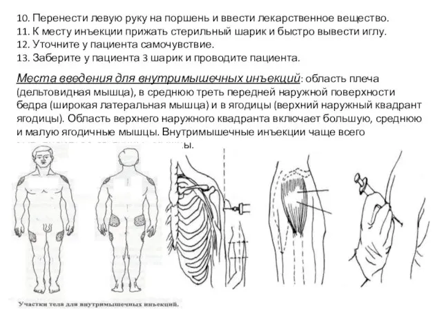 10. Перенести левую руку на поршень и ввести лекарственное вещество. 11.