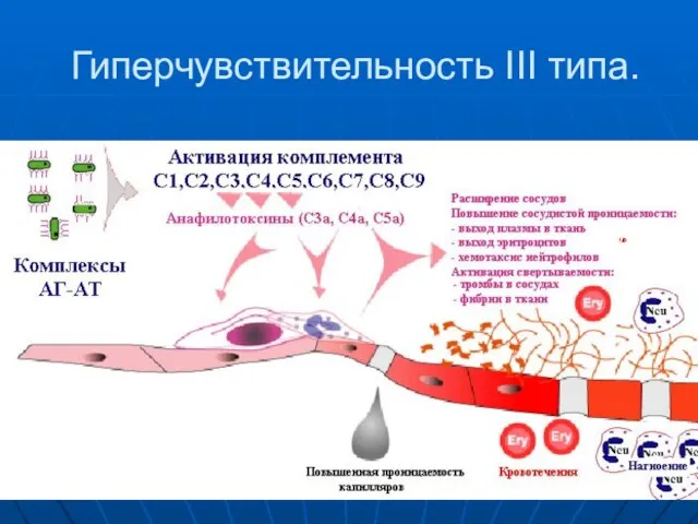 Гиперчувствительность III типа.