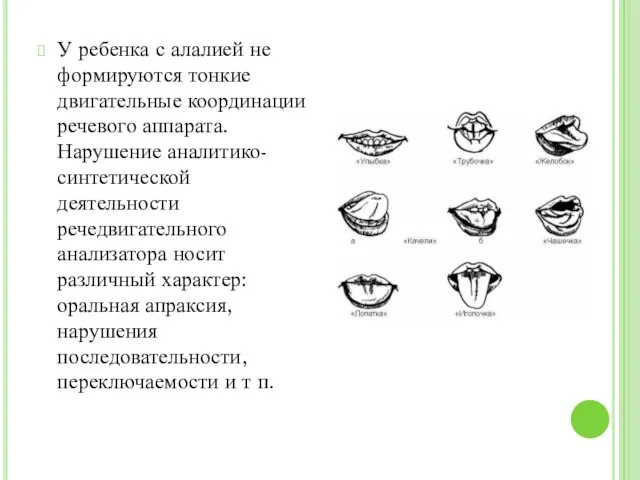 У ребенка с алалией не формируются тонкие двигательные координации речевого аппарата.