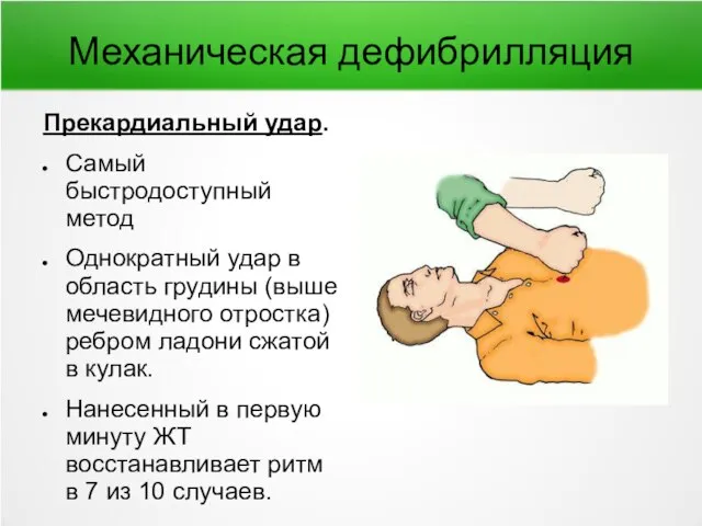 Механическая дефибрилляция Прекардиальный удар. Самый быстродоступный метод Однократный удар в область