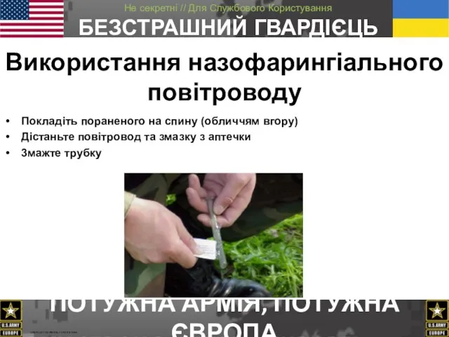 Використання назофарингіального повітроводу Покладіть пораненого на спину (обличчям вгору) Дістаньте повітровод