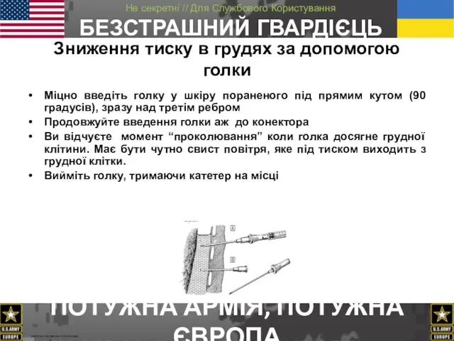 Зниження тиску в грудях за допомогою голки Міцно введіть голку у