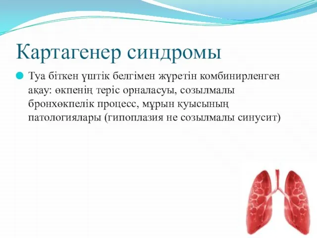 Картагенер синдромы Туа біткен үштік белгімен жүретін комбинирленген ақау: өкпенің теріс