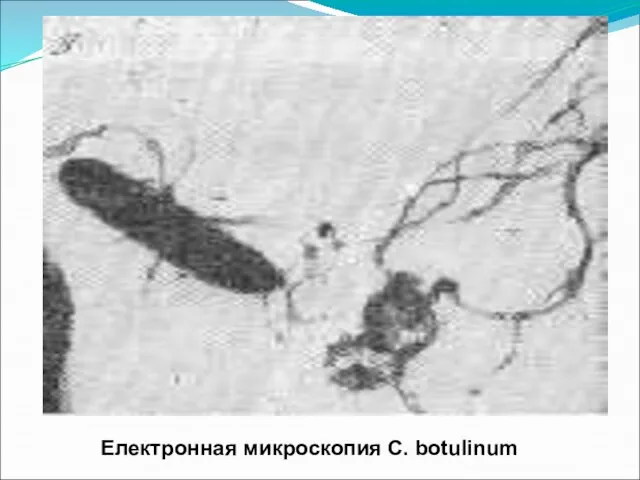 Електронная микроскопия C. botulinum