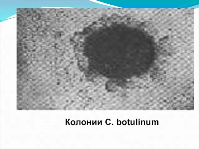 Колонии C. botulinum