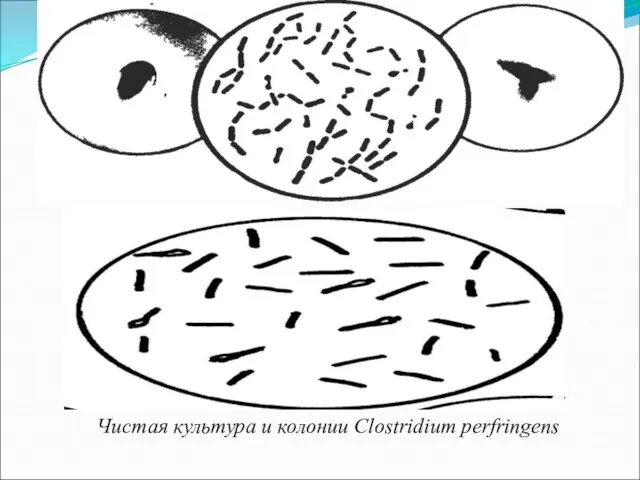Чистая культура и колонии Clostridium perfringens