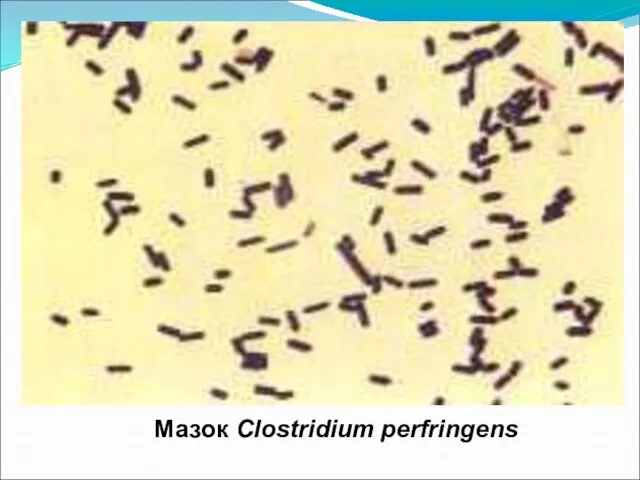 Мазок Clostridium perfringens