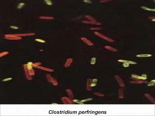 Clostridium perfringens