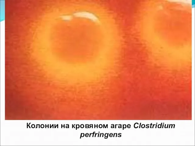 Колонии на кровяном агаре Clostridium perfringens