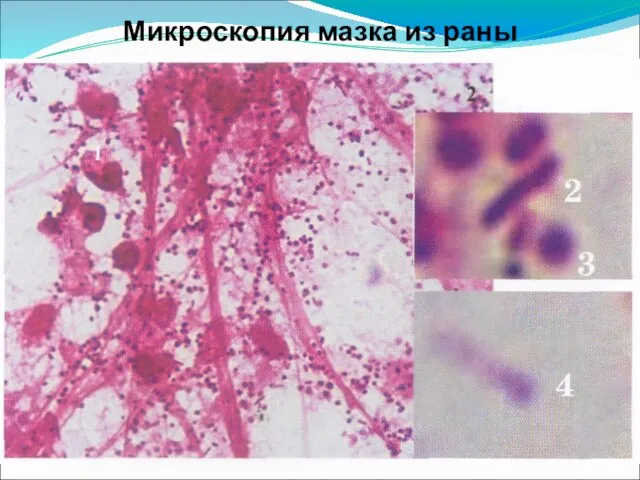 Микроскопия мазка из раны .