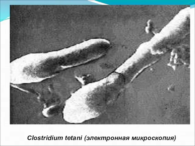 Clostridium tetani (электронная микроскопия)