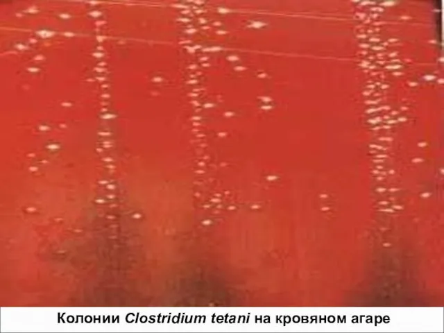 Колонии Clostridium tetani на кровяном агаре