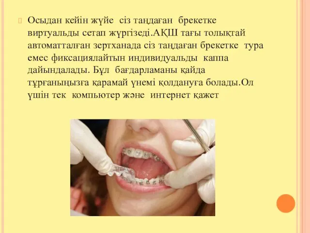 Осыдан кейін жүйе сіз таңдаған брекетке виртуальды сетап жүргізеді.АҚШ тағы толықтай