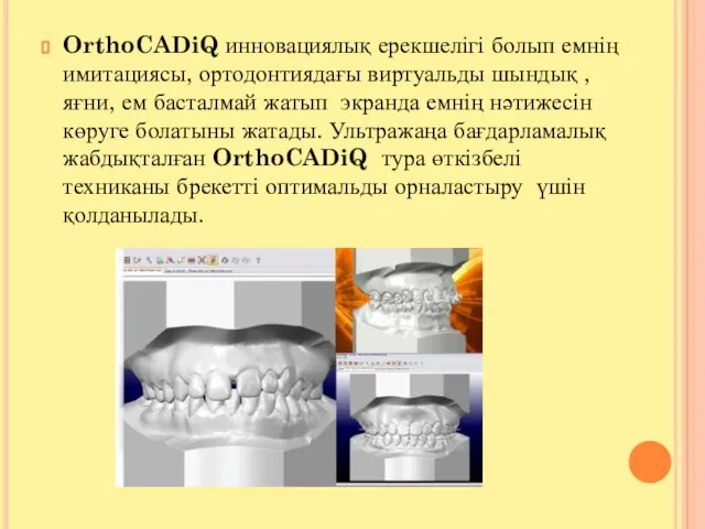 OrthoCADiQ инновациялық ерекшелігі болып емнің имитациясы, ортодонтиядағы виртуальды шындық ,яғни, ем