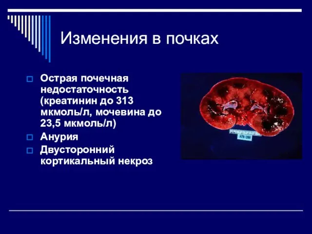 Изменения в почках Острая почечная недостаточность (креатинин до 313 мкмоль/л, мочевина