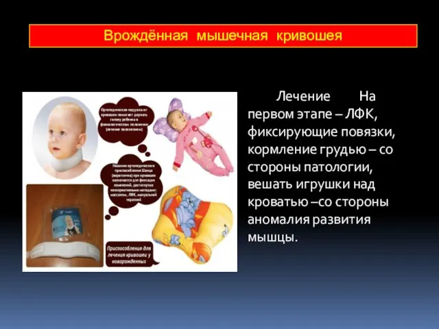 Лечение На первом этапе – ЛФК, фиксирующие повязки, кормление грудью –