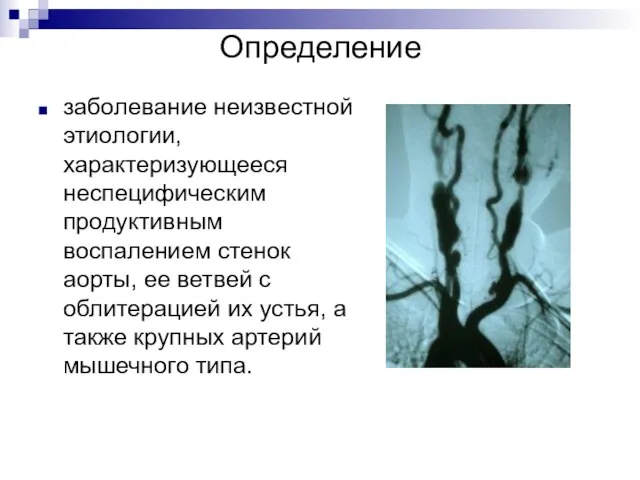 Определение заболевание неизвестной этиологии, характеризующееся неспецифическим продуктивным воспалением стенок аорты, ее