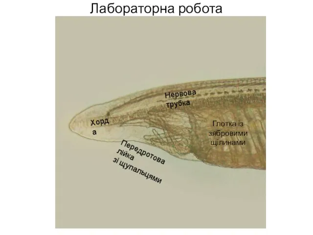 Лабораторна робота Хорда Передротова лійка зі щупальцями Нервова трубка Глотка із зябровими щілинами