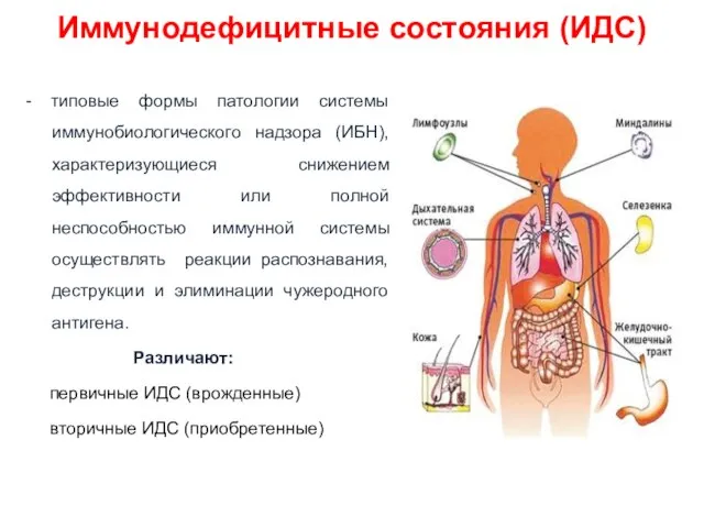 Иммунодефицитные состояния (ИДС) - типовые формы патологии системы иммунобиологического надзора (ИБН),