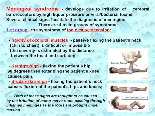 Meningeal syndrome - develops due to irritation of cerebral baroreceptors by