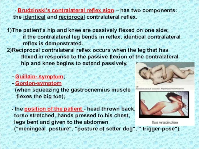 - Brudzinski’s contralateral reflex sign – has two components: the identical