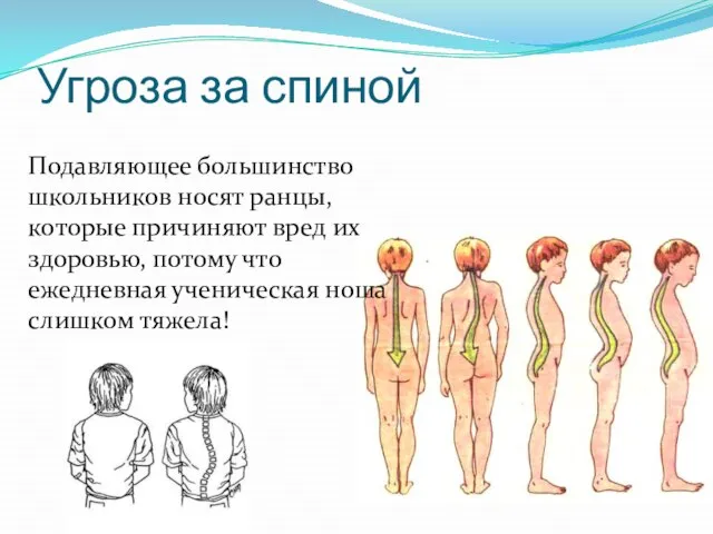 Угроза за спиной Подавляющее большинство школьников носят ранцы, которые причиняют вред