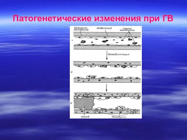 Патогенетические изменения при ГВ