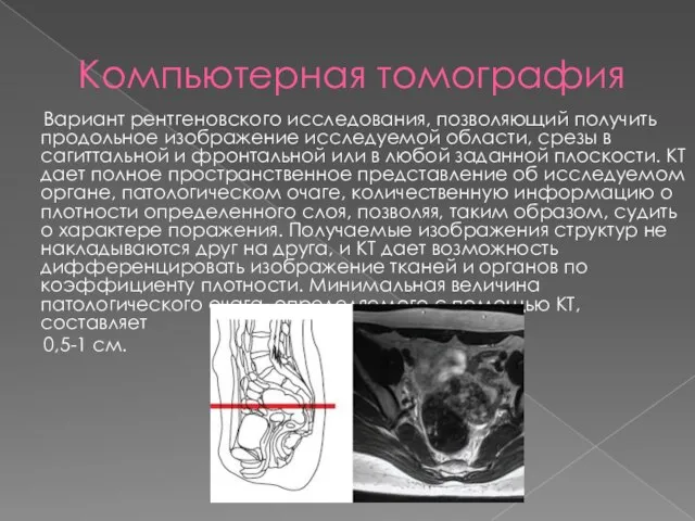 Компьютерная томография Вариант рентгеновского исследования, позволяющий получить продольное изображение исследуемой области,