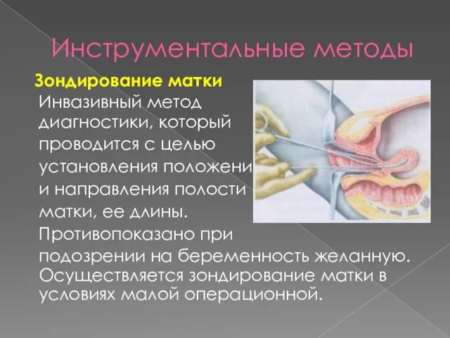 Инструментальные методы Зондирование матки Инвазивный метод диагностики, который проводится с целью